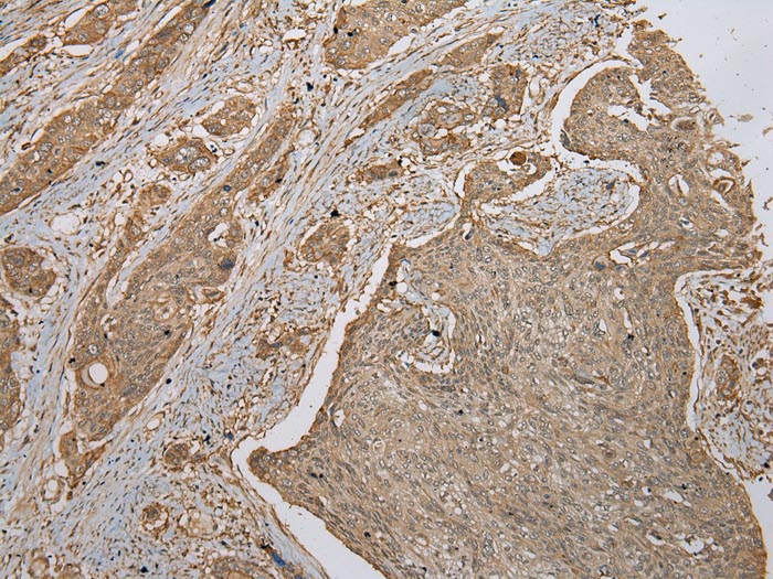 Anti-FNDC3B Antibody