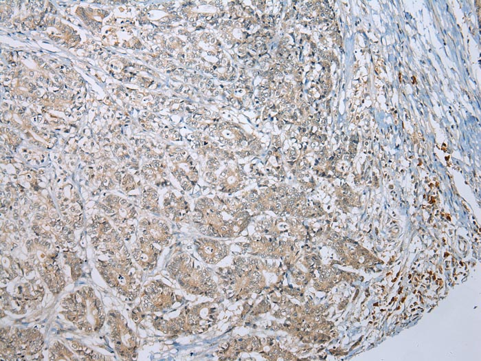 Anti-MLLT11 Antibody