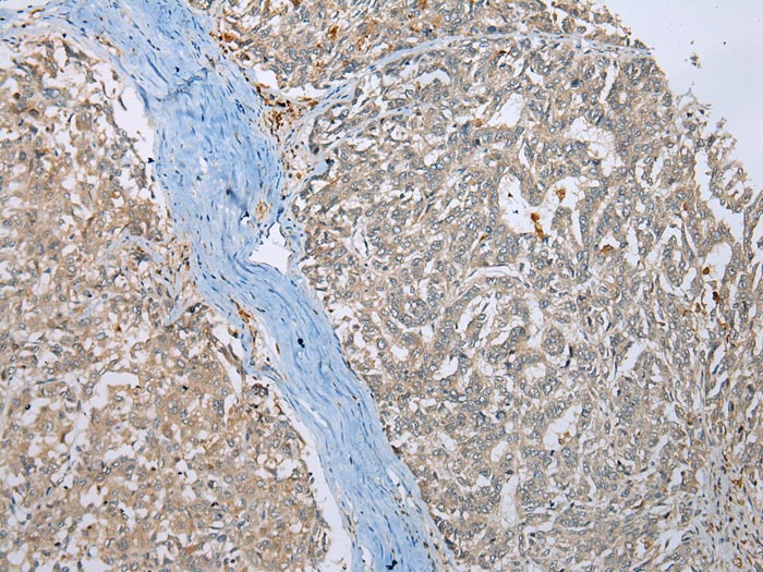 Anti-MLLT11 Antibody Anti-MLLT11 Antibody