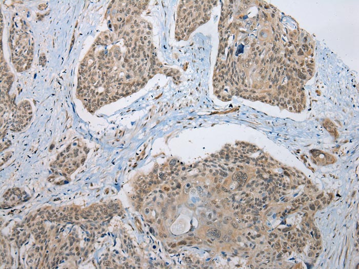 Anti-NUDCD3 Antibody