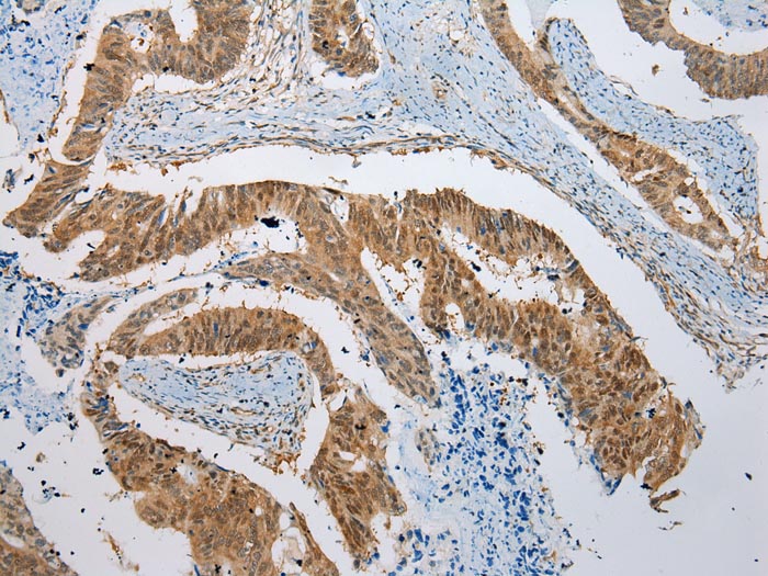 Anti-NUDCD3 Antibody Anti-NUDCD3 Antibody