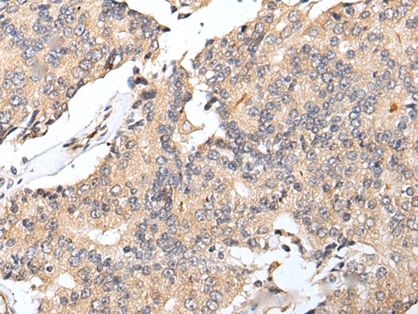 Anti-RNF141 Antibody