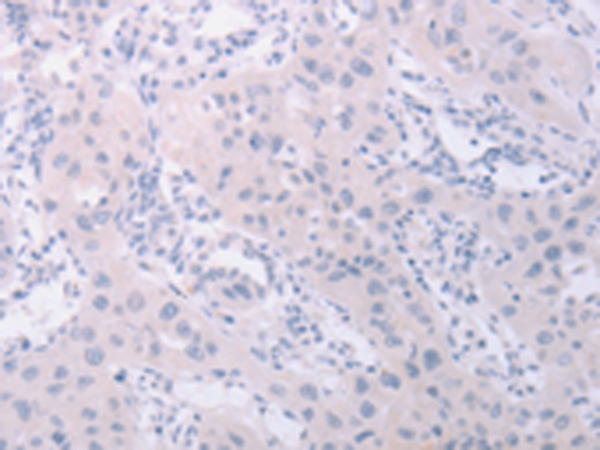 Anti-PKD2L1 Antibody