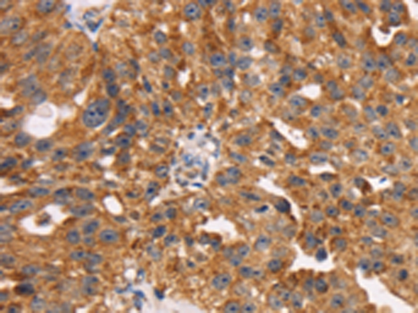 Anti-TM4SF1 Antibody