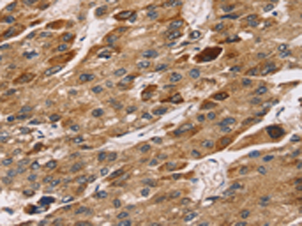 Anti-TM4SF1 Antibody Anti-TM4SF1 Antibody