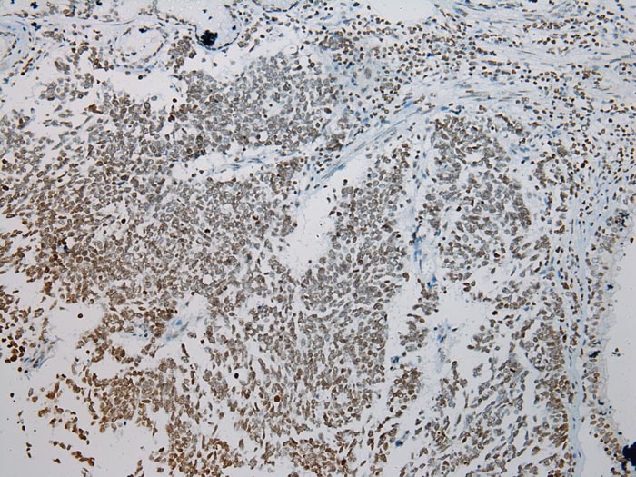 Anti-ZNF200 Antibody