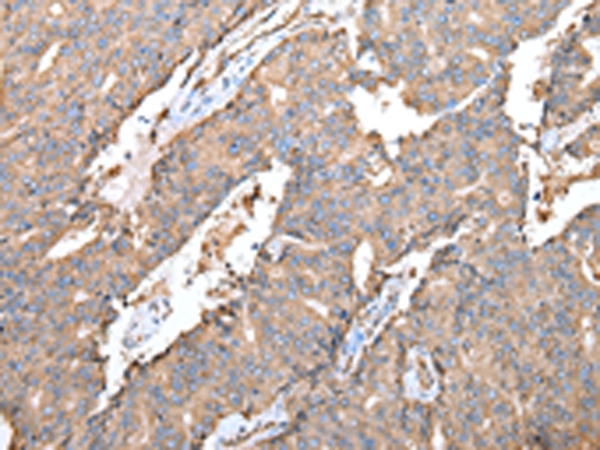 Anti-SPINK7 Antibody