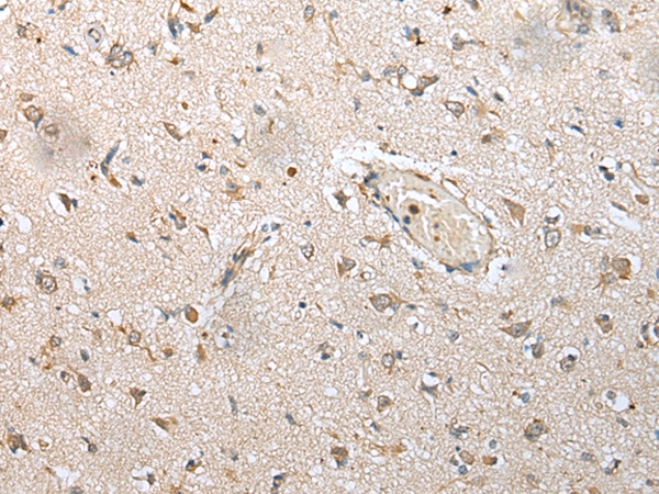 Anti-NUDT14 Antibody