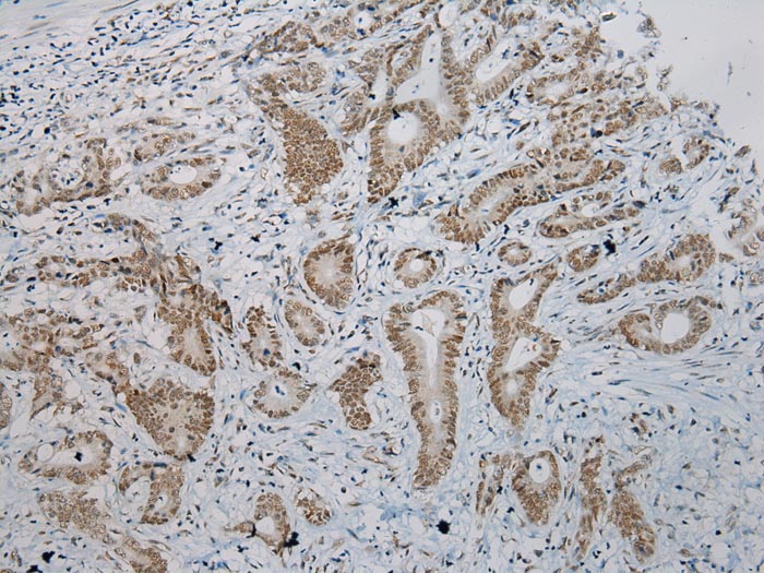 Anti-ZNF473 Antibody