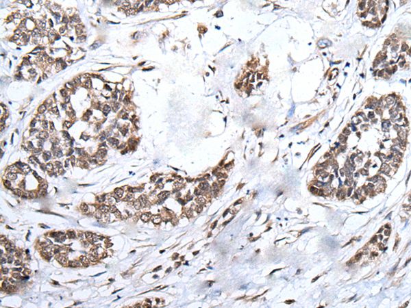 Anti-BRMS1L Antibody