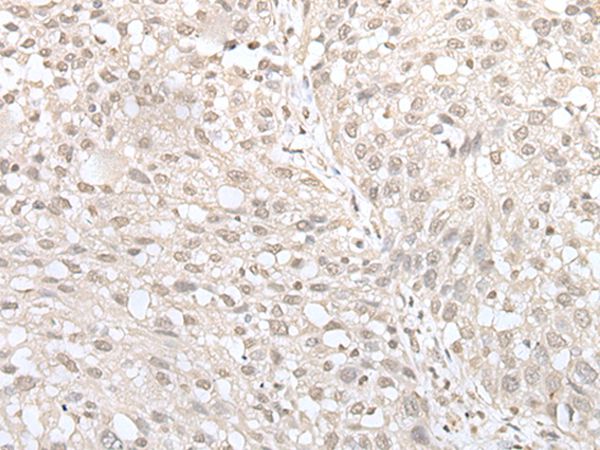 Anti-MIF4GD Antibody