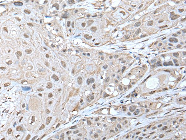 Anti-ZNF277 Antibody