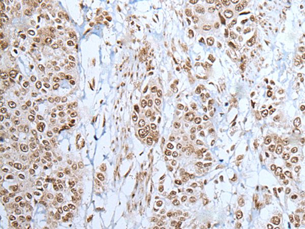 Anti-ZNF302 Antibody