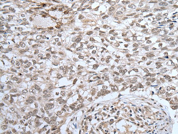 Anti-ZNF37A Antibody
