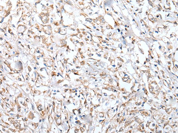 Anti-VPREB3 Antibody