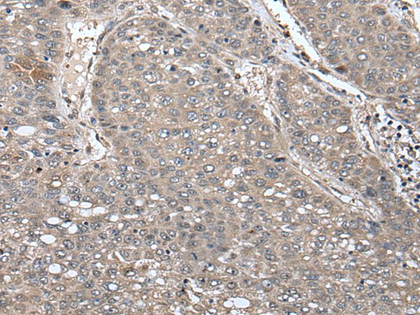 Anti-UNC45B Antibody