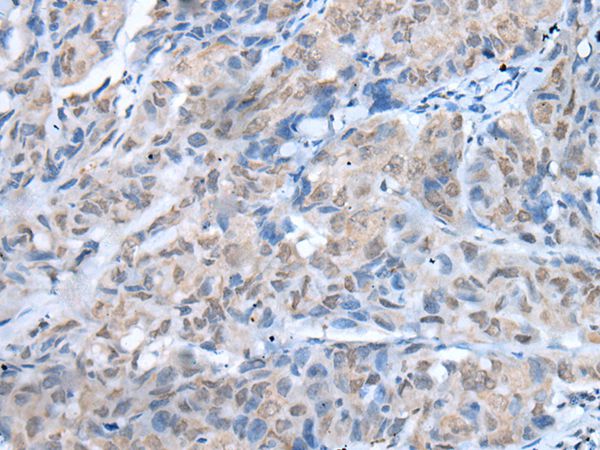 Anti-TMEM97 Antibody