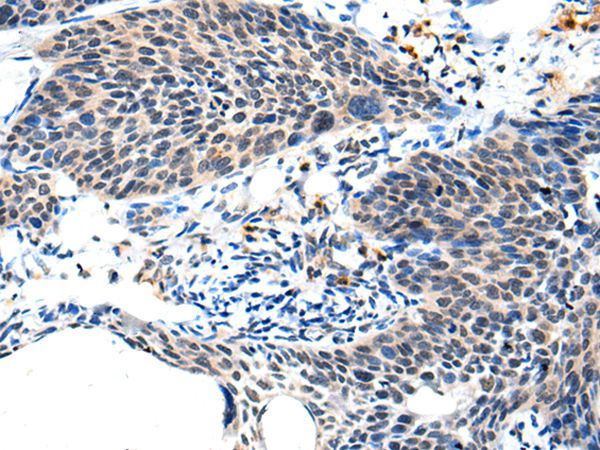 Anti-ALS2CL Antibody