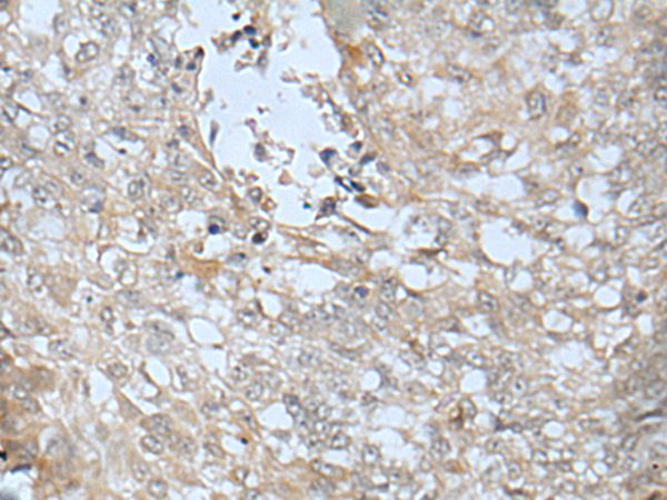 Anti-LRRC23 Antibody