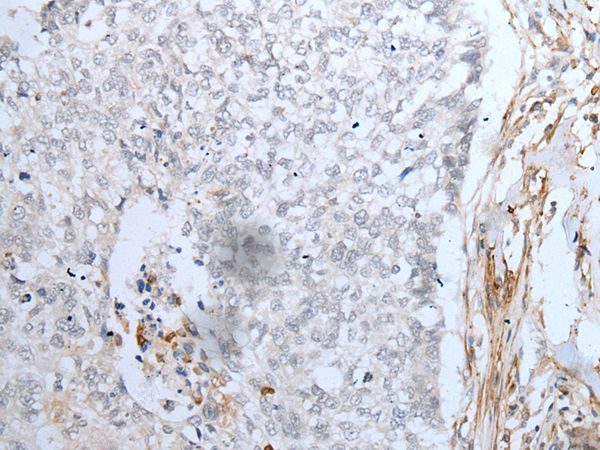Anti-MAGEB5 Antibody Anti-MAGEB5 Antibody