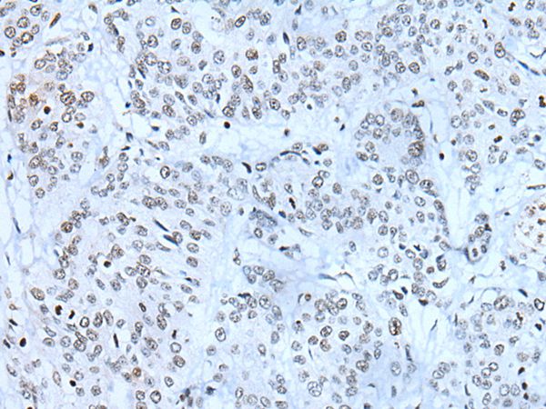 Anti-ZBTB11 Antibody