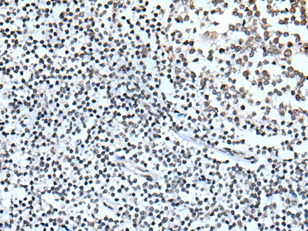 Anti-ZBTB11 Antibody Anti-ZBTB11 Antibody
