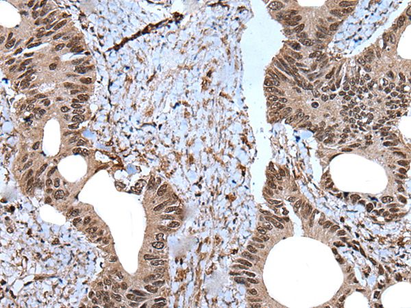 Anti-ZNF787 Antibody