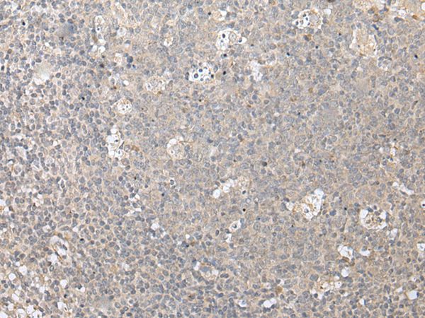 Anti-ZFYVE1 Antibody