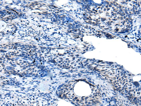 Anti-GAS2L3 Antibody