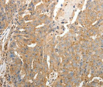 Anti-SFTPD Antibody Anti-SFTPD Antibody