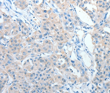 Anti-AKAP9 Antibody