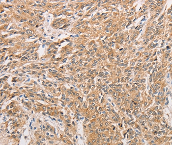 Anti-WNT11 Antibody Anti-WNT11 Antibody