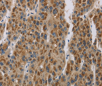 Anti-LOXL4 Antibody