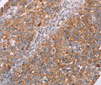 Anti-RMDN3 Antibody
