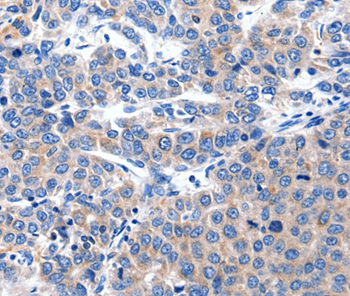 Anti-KCNH8 Antibody Anti-KCNH8 Antibody