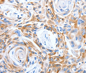 Anti-LRIG3 Antibody