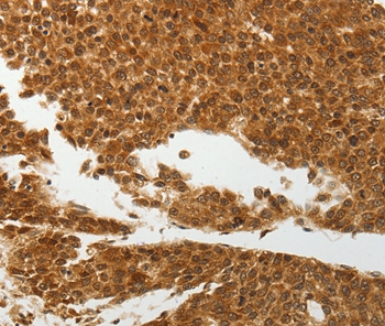 Anti-SOCS7 Antibody