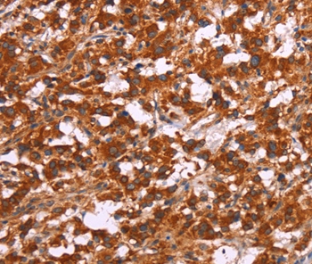 Anti-ARPC4 Antibody