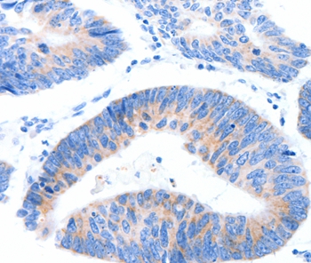 Anti-MUC3A Antibody