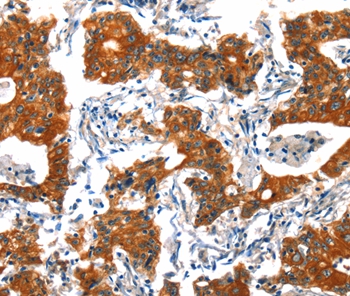 Anti-HTR3B Antibody