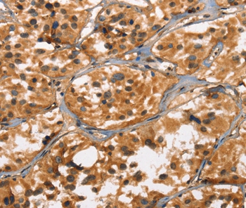 Anti-DEFA5 Antibody Anti-DEFA5 Antibody