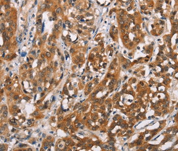 Anti-SH2B2 Antibody Anti-SH2B2 Antibody