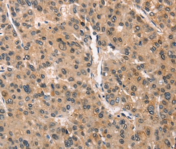 Anti-CRIM1 Antibody