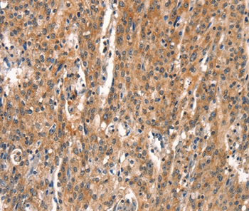 Anti-DEAF1 Antibody