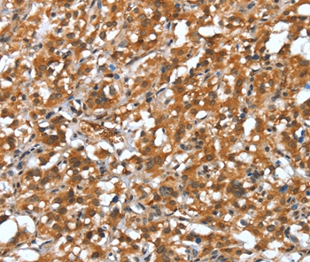 Anti-DEFA4 Antibody