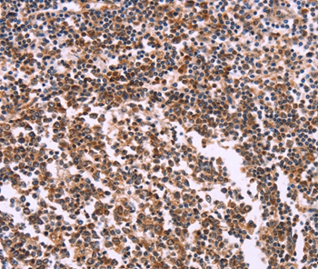 Anti-MSMO1 Antibody