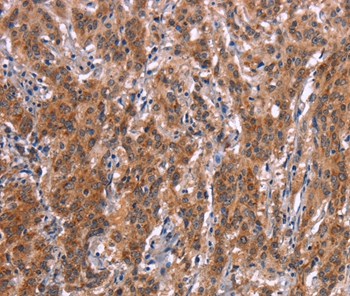 Anti-FDCSP Antibody