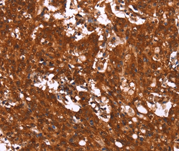 Anti-HCAR2 Antibody