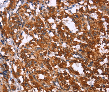 Anti-GPR65 Antibody