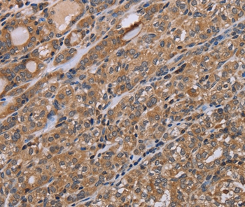 Anti-NAA25 Antibody